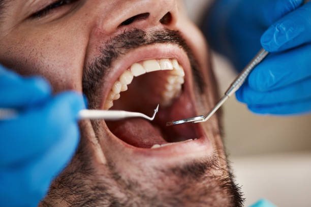 Urgent Tooth Repair in IL